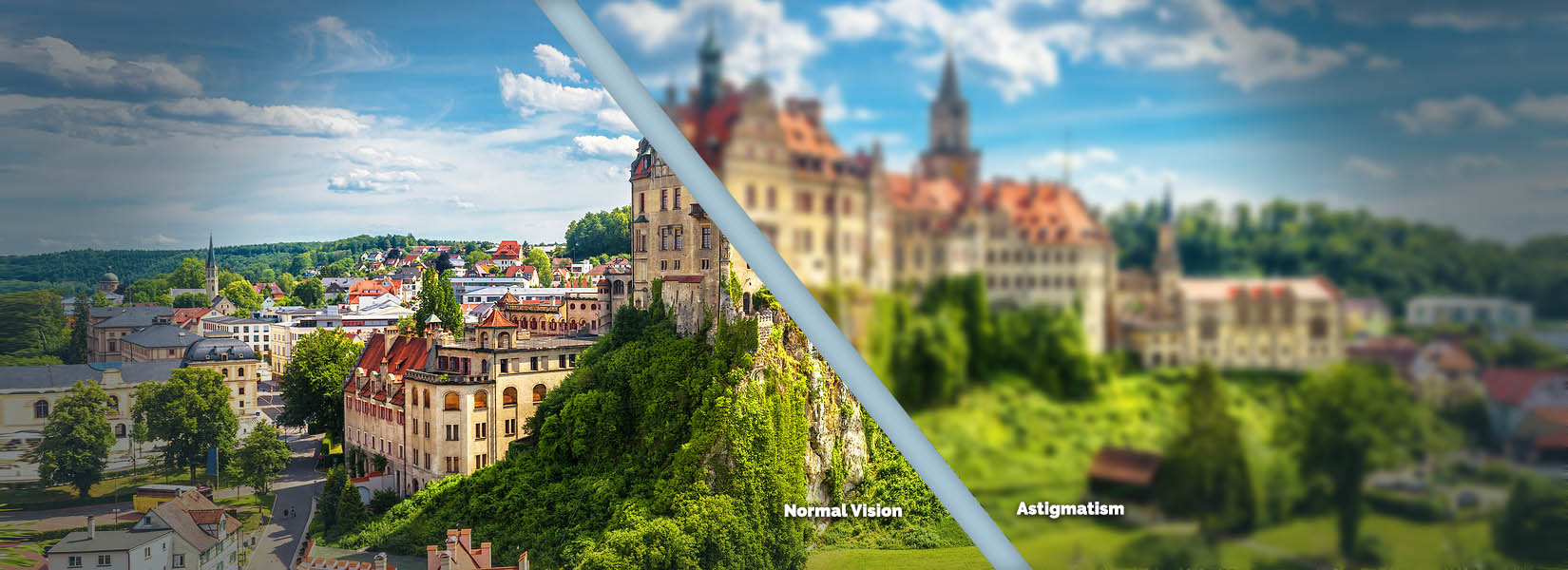 Astigmatism Treatment in Melbourne