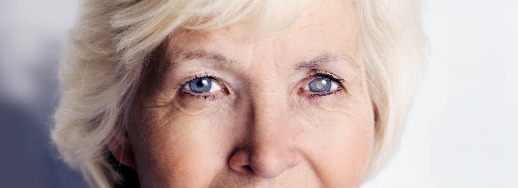 Cataract Surgery in Melbourne
